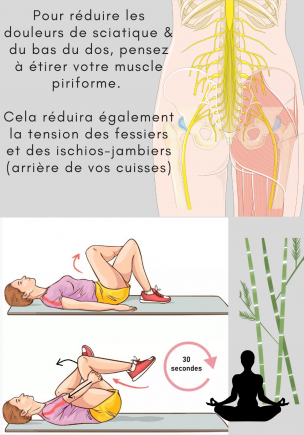 Sciatique
